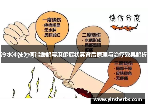 冷水冲洗为何能缓解荨麻疹症状其背后原理与治疗效果解析